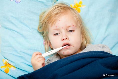 Tips To Care For A Child Suffering From Measles