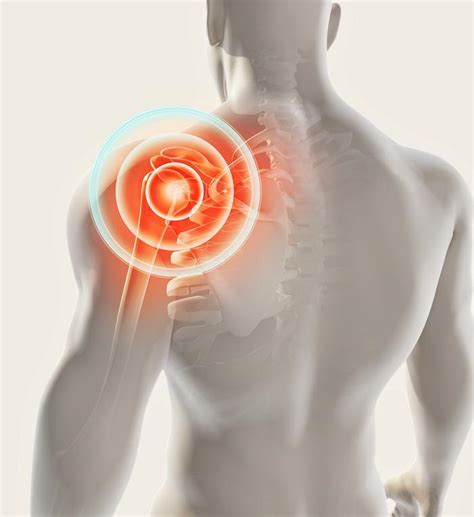 Are You Suffering From Severe Shoulder Pain It Could Be A Sign Of A