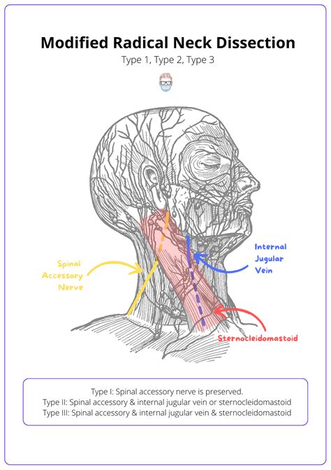 Neck Dissection · Types Anatomy Indications Complications