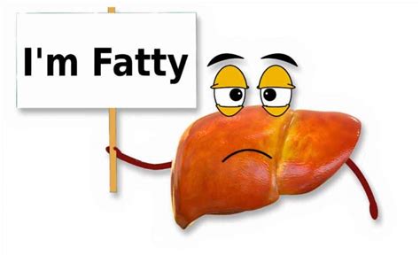 Fatty Liver Disease Fld Hepatic Steatosis All You Need To Know