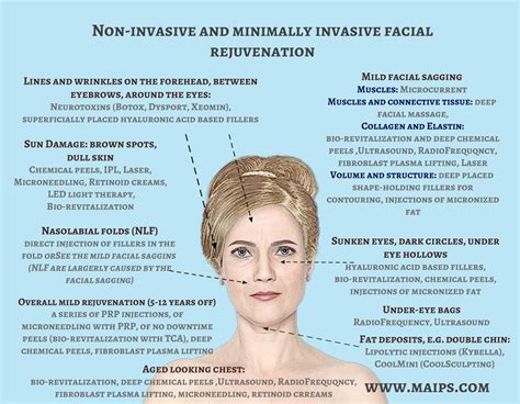 Minimally Invasive Facial Rejuvenation Options Maips Medical Aesthetics Information Platform