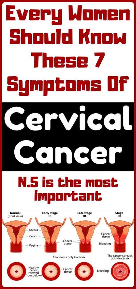 Warning Symptoms Of Cervical Cancer That Every Women Should Know Wellness Right