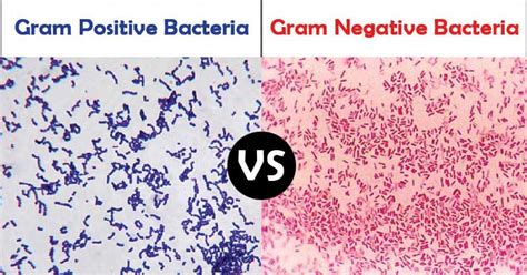 Gram Positive Vs Gram Negative Bacteria Key Differences Gram Negative Bacteria Negativity