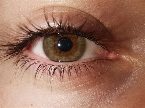 I Have Central Heterochromia Rmildlyinteresting