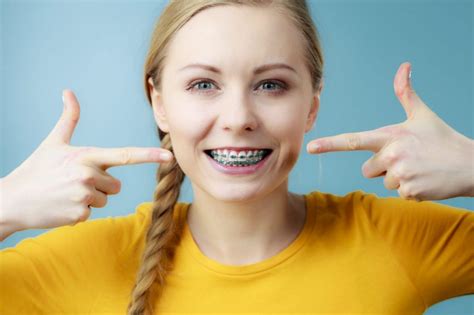 Dental Insurance And Braces What You Need To Know Bro News