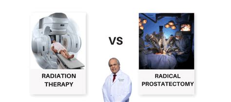 Radiation Therapy Vs Prostatectomy Pelo Dr Razdan Melhor Urologista