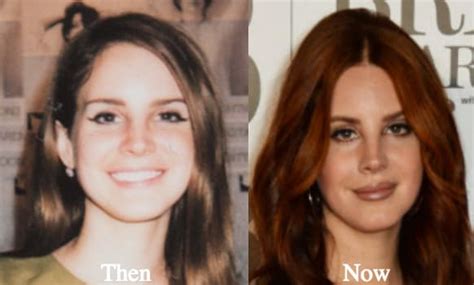 Lana Rhodes Before Plastic Surgery