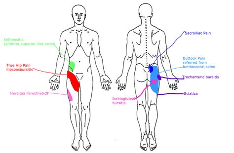 Hip And Groin Pain Elim Rheumatic Centre