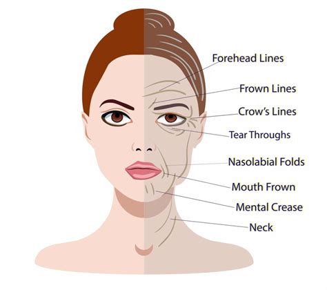 Types Of Lines On Face Wrinkles Glam Skin Review