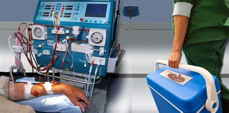 Kidney Dialysis And Transplant Know Pathology Know Healthcare