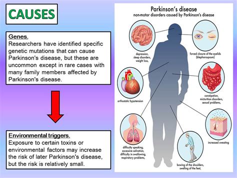What Causes Parkinsons Disease
