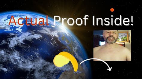 The Naked Truth About My Foreskin Restoration Pt Youtube