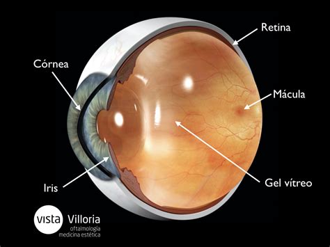 diferencia entre desgarro y desprendimiento de retina clínica villoria