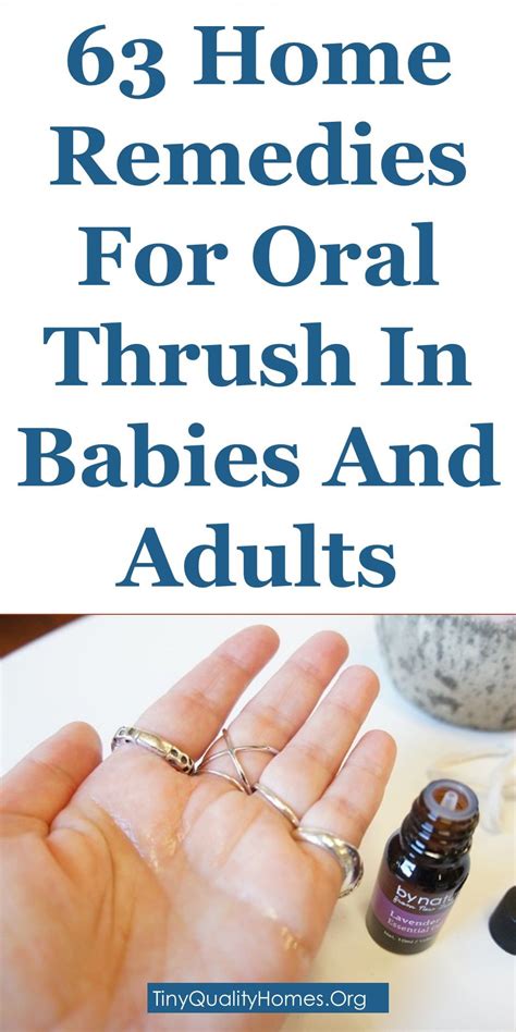 63 Home Remedies For Oral Thrush In Babies And Adults Baby Thrush