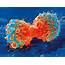 Israeli Researchers Discover How Tumors Become Resistant To Drugs And 