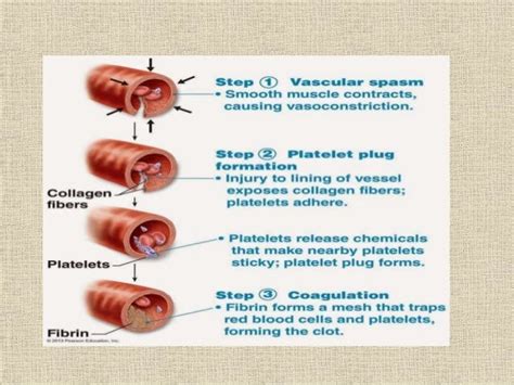 ppt disseminated intravascular coagulation powerpoint presentation 844