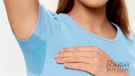 Hyperhidrosis For Underarms Treatments Benefits Risks