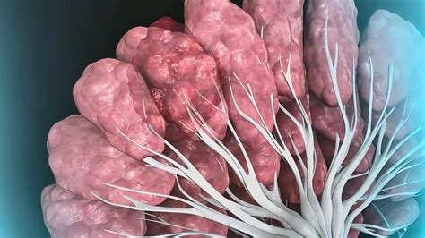 Prosigna Test Impacts Adjuvant Treatment Decisions In Lymph Node
