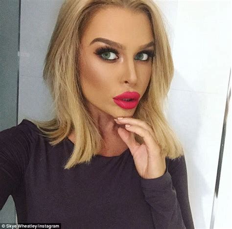 Skye Wheatley Vows On Instagram To Get Nose Job Following Botched