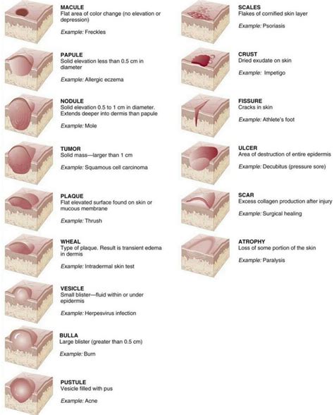 Types Of Skin Lesions Coolguides