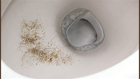 How To Get Rid Of Mold In Toilet Causes Solutions