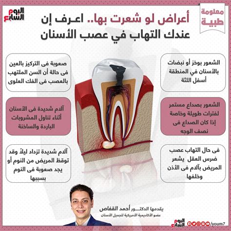 شكل عصب الاسنان