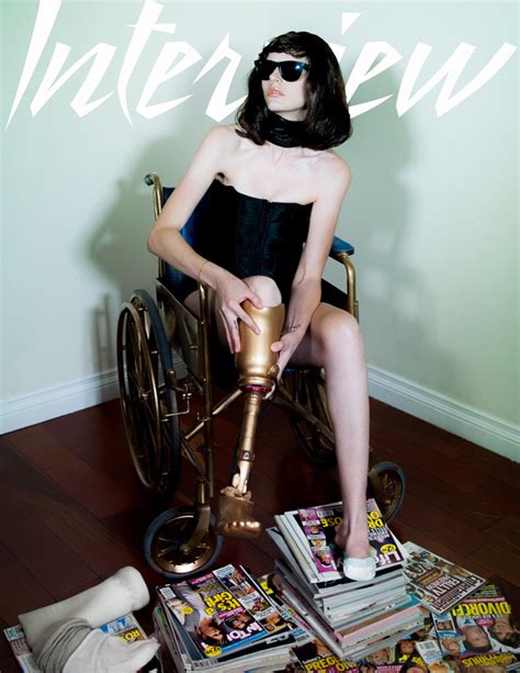 Model Who Lost Leg Recreates Kylie Jenners Wheelchair Shoot E News