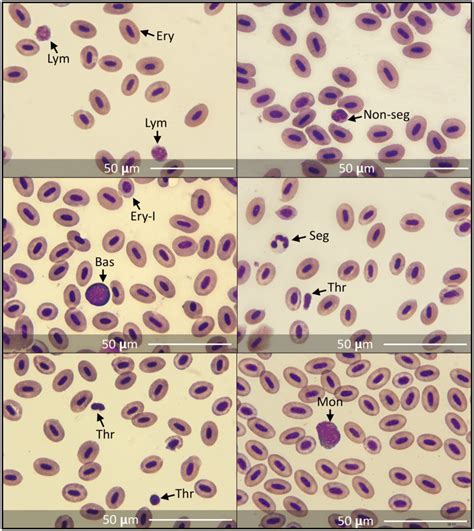 Blood Cell Types Of Brook Trout Lym Lymphocytes Ery Erythrocytes