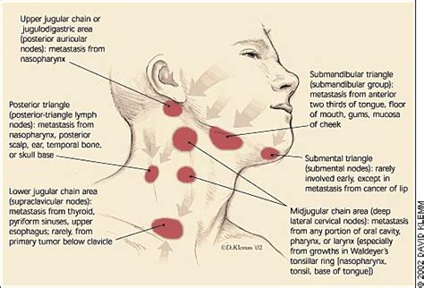 Chronic Enlarged Lymph Nodes In Neck Things You Didnt Know