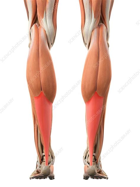 Also used to hold the leg or foot muscles and tendons in place after surgery to allow applied from the upper thighs to the feet. Leg tendons - Stock Image - F016/2521 - Science Photo Library