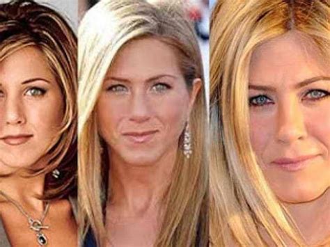 If you look at her nose from the before photo, she used to have a thicker nasal bridge and a more spongy nose tip. Jennifer Aniston Plastic Surgery Jennifer Aniston Nose JOb ...