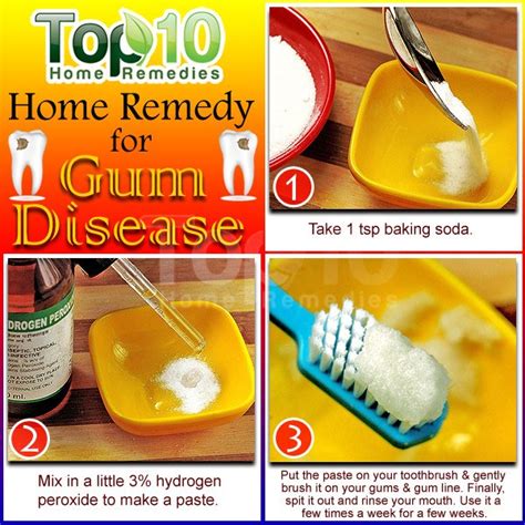 Natural Home Remedies For Gum Disease Top 10 Home Remedies