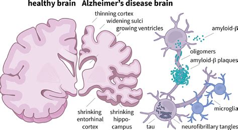 Single Cell Insights Into An Alzheimers Disease Drug Target 10x Genomics