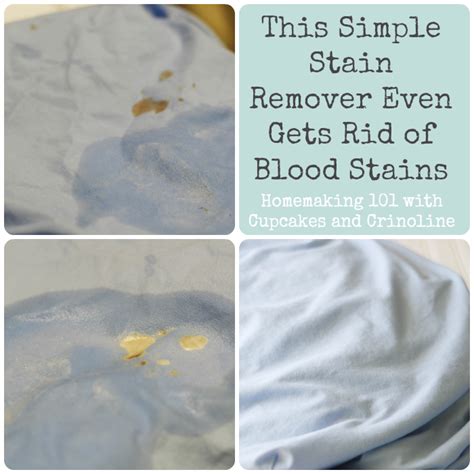 How To Remove Blood Stains After Washing Howtoremvo