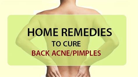 5 Home Remedies For Back Acne