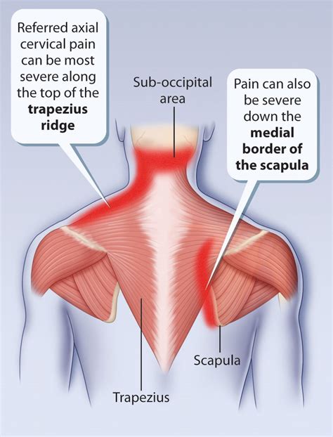 A pharmacist can help with shoulder pain. Got Shoulder Pain? Don't be surprised if your massage therapist starts working on your neck.