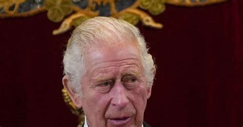 Rei Charles III Por Que Monarca Tem Dedos De Salsicha