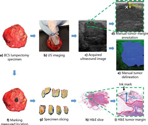 Figure 1 From Toward Intraoperative Margin Assessment Using A Deep Learning Based Approach For