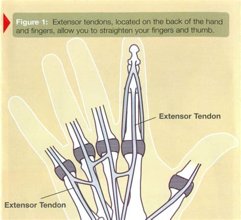 Hand Extensor Tendon Zones