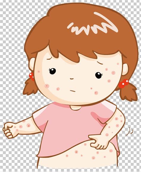 Miliaria Stock Photography Skin Rash Png Clipart Blister Boy