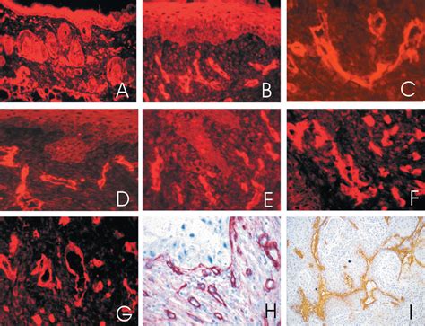 Dmba Induced Lesions In Mouse Skin A F Vegf Expression In