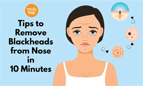 Tips To Remove Blackheads From Nose In 10 Minutes Medy Life