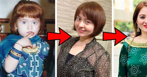 This Gorgeous Indian Woman Who Was Born With Red Hair