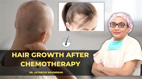How To Grow Your Hair Out After Chemotherapy Or Cancer Treatment Dr