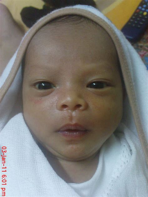 Demam kuning atau 'jaundice' adalah perkara biasa yang berlaku pada bayi. Cik Puan Tasha: Demam Kuning atau Jaundice