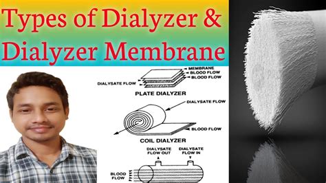 Dialyzer Types Of Dialyzer And Dialyzer Membrane Dialyzer Membrane
