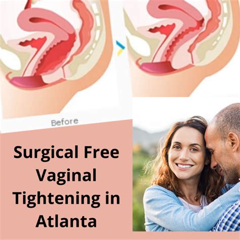 Do You Know These Amazing Benefits Of Vaginal Tightening Available Ideas