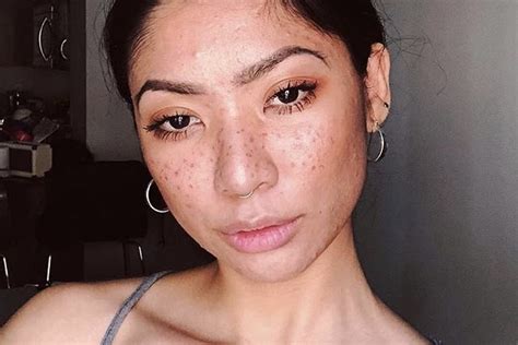 How To Makeup With Freckles Saubhaya Makeup