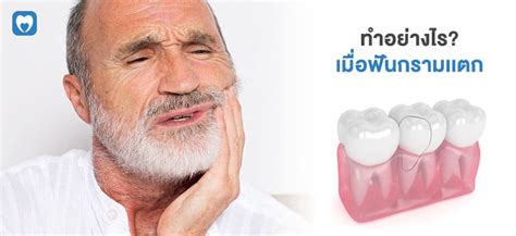 ทำอย่างไรเมื่อฟันกรามแตก (Cracked Tooth) | Care Dental Clinic