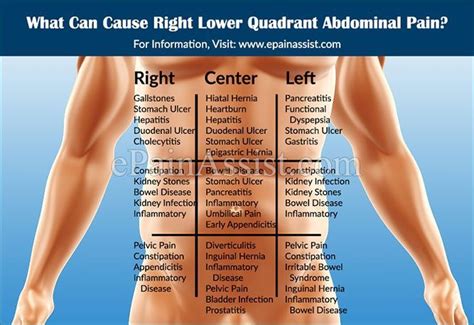 Abdominal computed tomography (ct) is a type of medical imaging procedure used to diagnose and monitor internal stomach issues, like cancer, bowel obstruction, and abdominal pain. Pin on Unlock Hip Flexor Tips